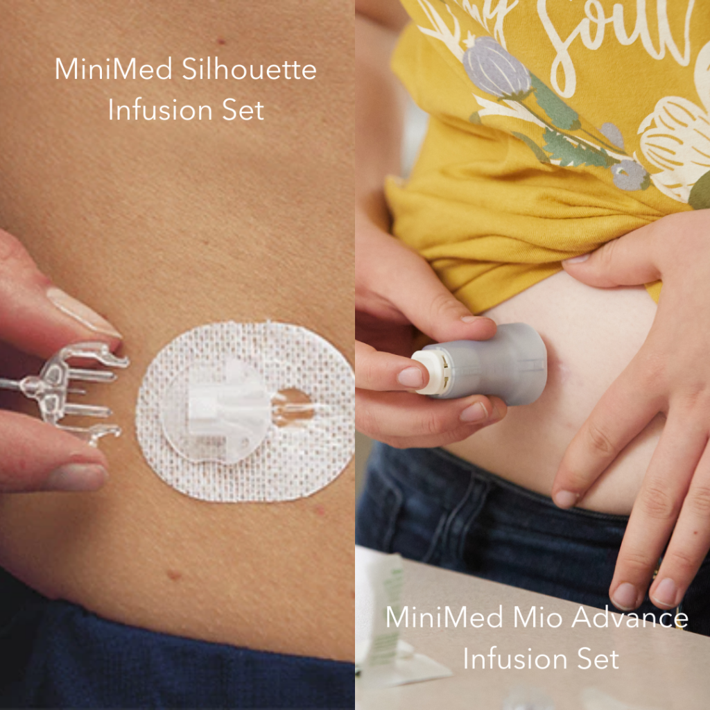 Which Infusion Set Is Right For You? The LOOP Blog